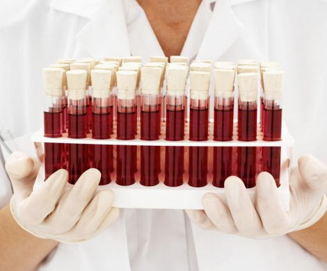 Ученые: у людей появились новые группы крови из-за радиации‍