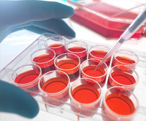 В Австралии будут применять стволовые клетки для лечения болезни Паркинсона