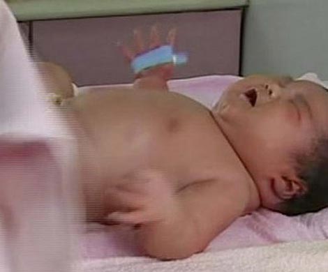 В Австралии у 272-килограммовой матери родился огромный ребенок