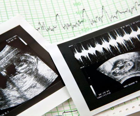 В РПЦ призвали защищать права человеческого эмбриона